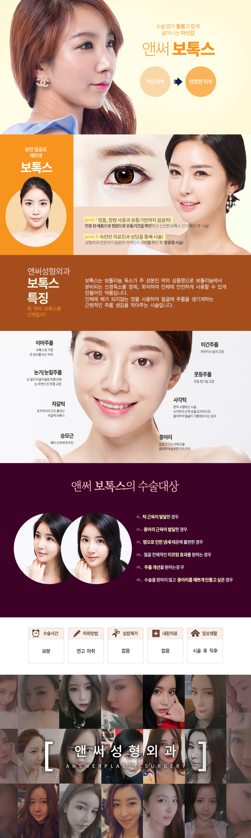 보톡스